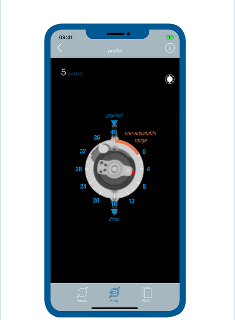 Screenshot der Hydrocephalus MIETHKE App – die Röntgenansicht zeigt, wie die Druckstufen der MIETHKE Shunts im Röntgen aussehen, für ein leichtes Ablesen der Shunt Einstellung im Röntgen.