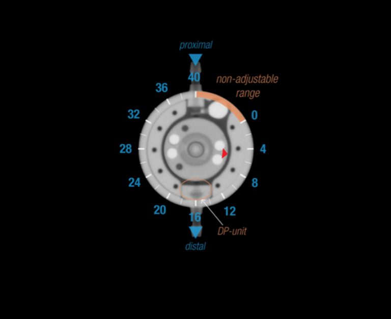 M.blue X-ray image with marked pressure level scalar