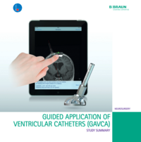 D-NE16005-GAVCA-Studie-Flyer.pdf