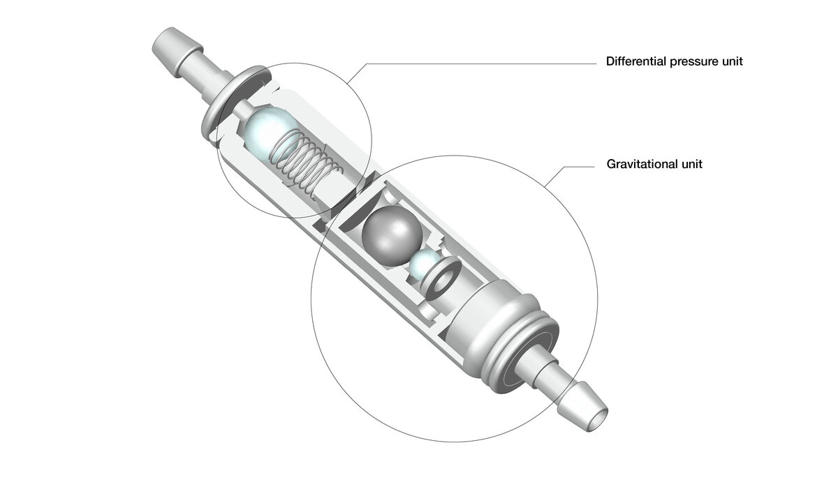 GAV Pressure Stages X-Ray Example