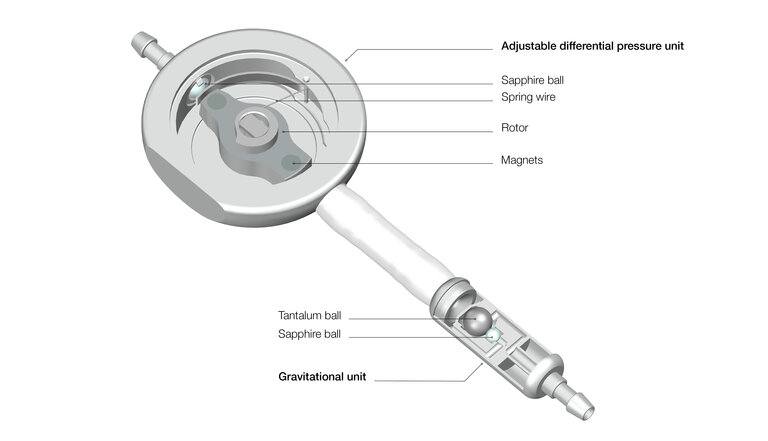 Cross-section of a proGAV shunt with description