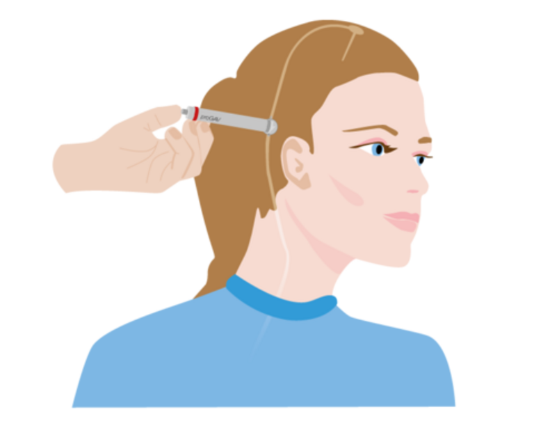 Illustration of the use of an adjustment instrument with the proGAV