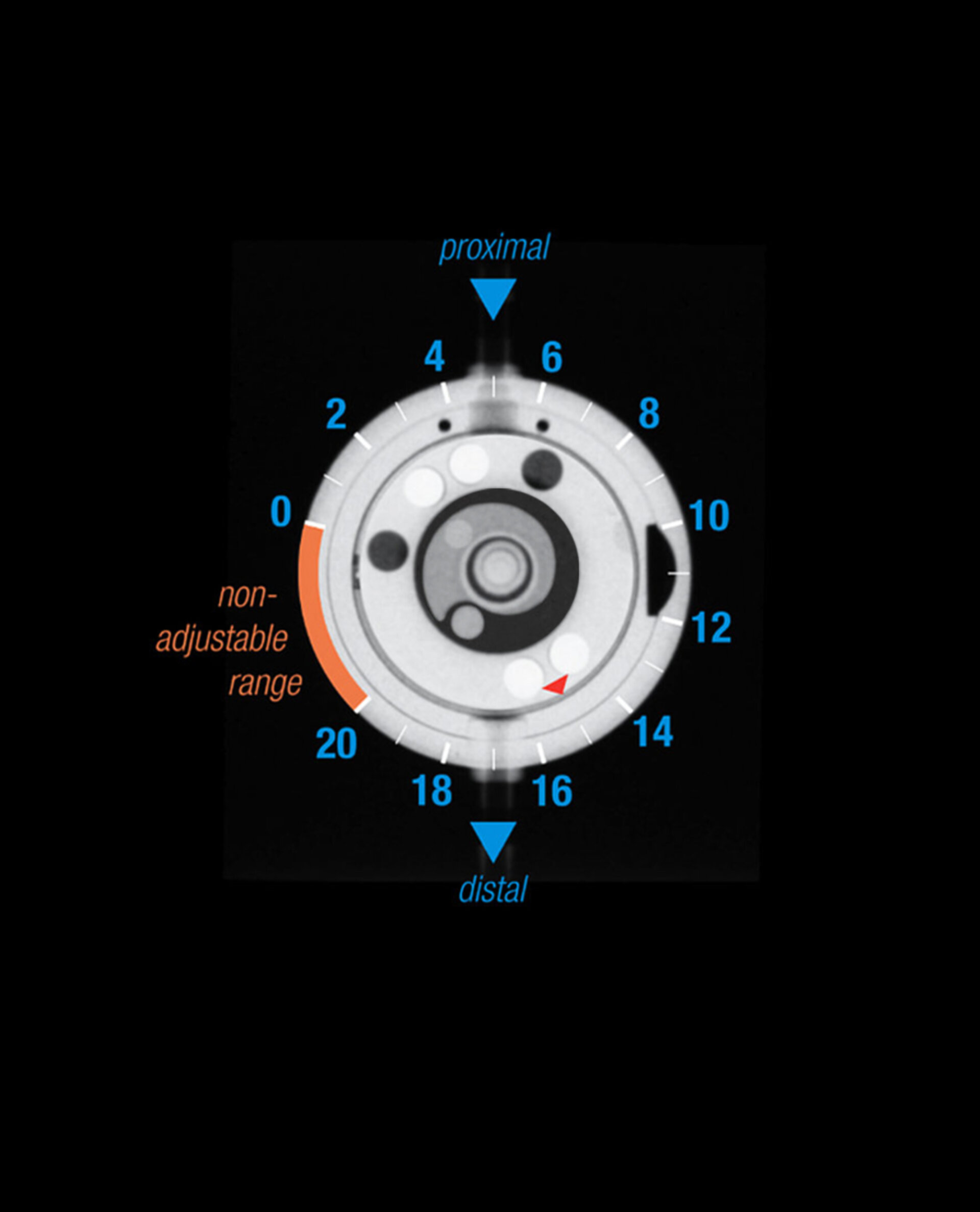 proGAV 2.0 Pressure Level X-ray