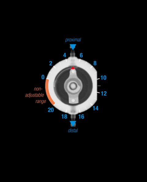 proGAV Pressure Level X-ray